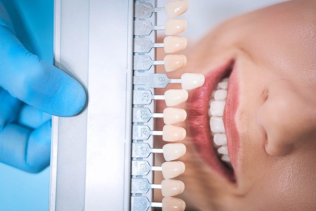 ¿Salud o estética?