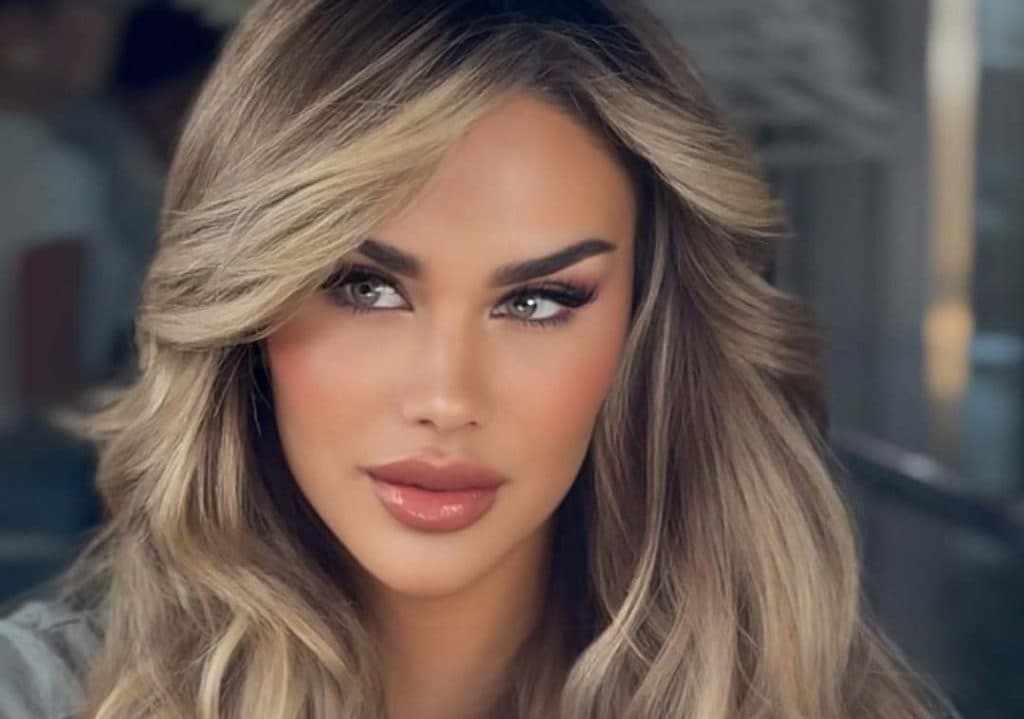 Ninel Conde se somete a una cirugía para cambiar el color de sus ojos: así luce ahora