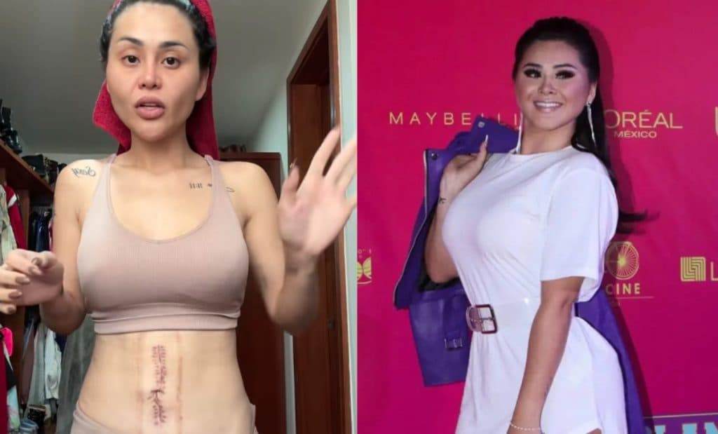 Gomita tuvo que ser operada de emergencia por bloqueo total de sus intestinos