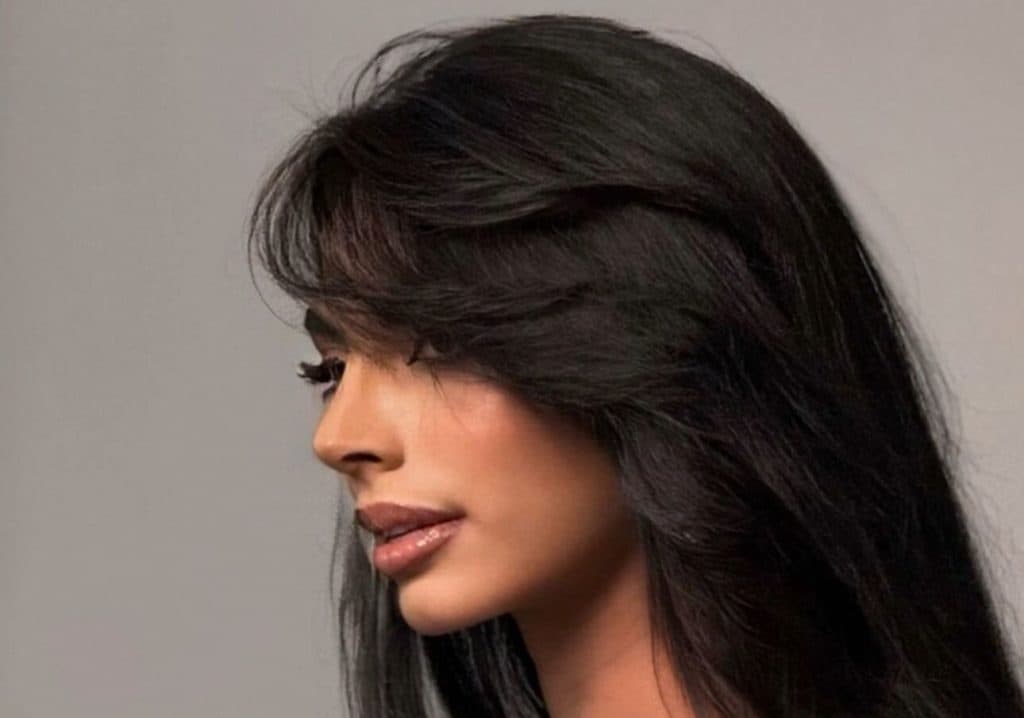 Giulia Zanoni presume su nuevo rostro tras retoque estético: así luce ahora la reina de belleza