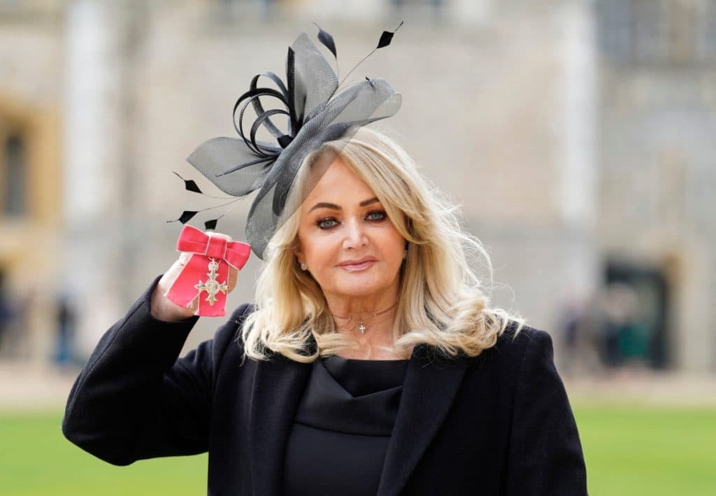 La cantante Bonnie Tyler salió del coma inducido