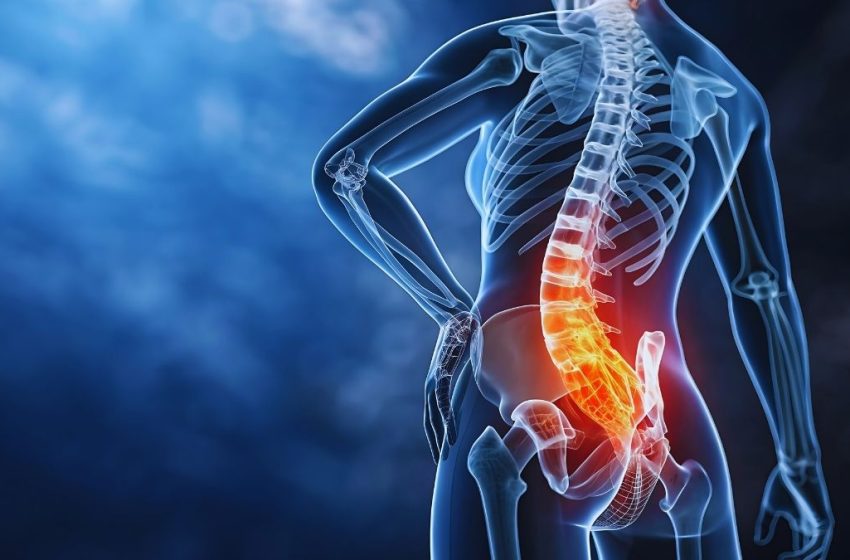  Adiós a la ciática: Consejos y tratamientos para recuperar tu movilidad
