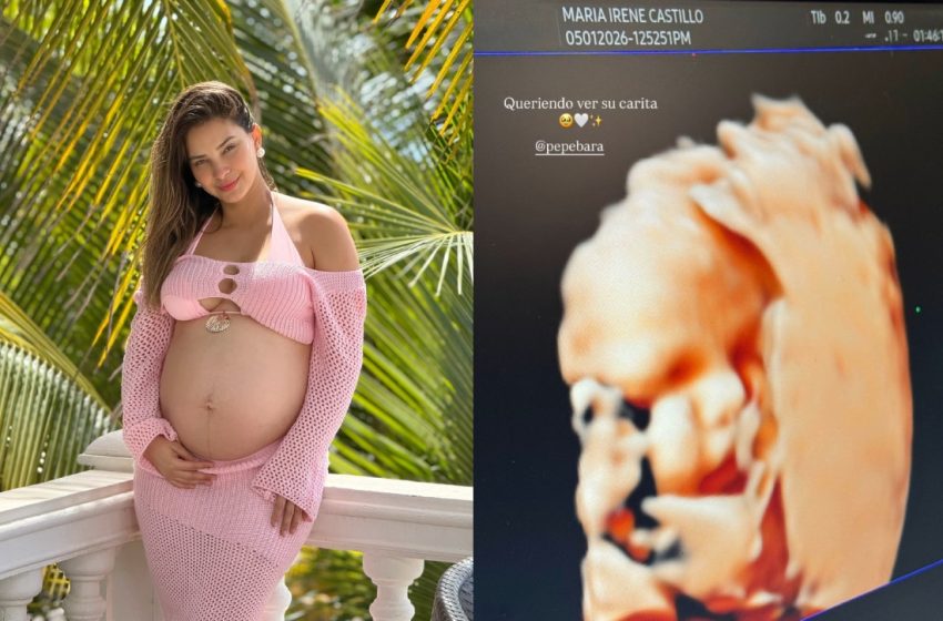  Irene Castillo y Pepe Barahona conmueven al ver por primera vez el rostro de su bebé