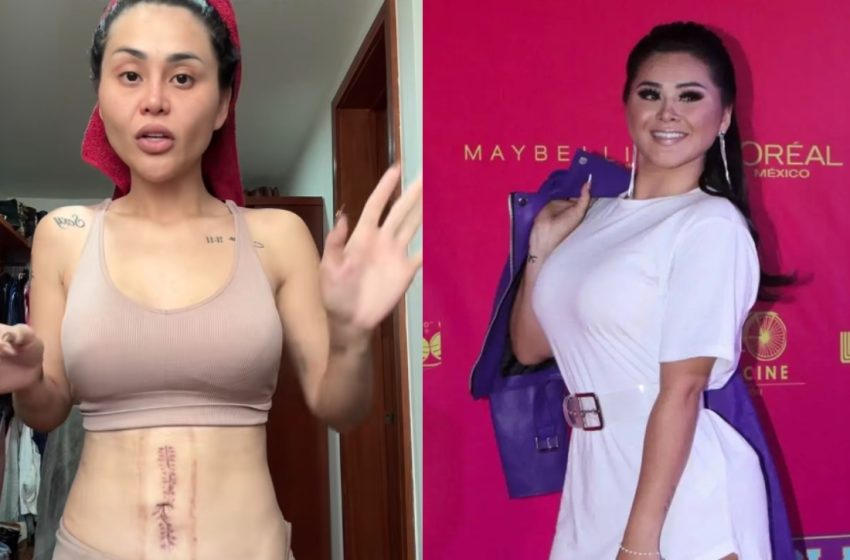  Gomita tuvo que ser operada de emergencia por bloqueo total de sus intestinos