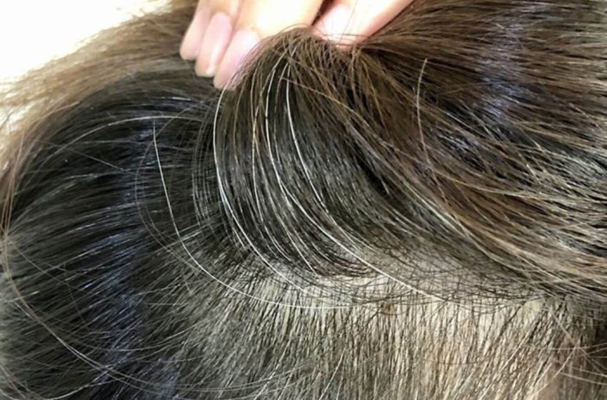  El asombroso secreto de salud detrás de las canas prematuras