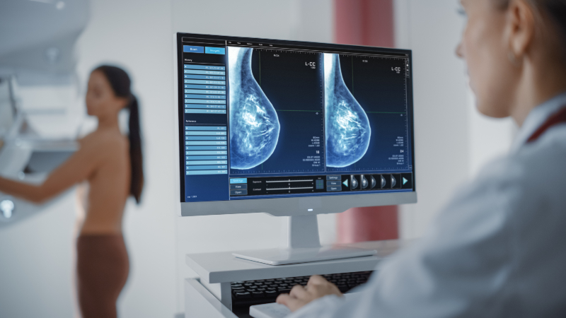  Especialistas destacan avances que mejoran el tratamiento del cáncer de mama